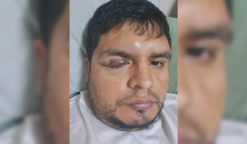 Jujuy: patovicas atacan a hombre y su pareja por darse besos en público