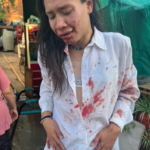 En la madrugada de Año Nuevo, la localidad de Don Torcuato fue escenario de un violento ataque contra Verdún Mar Desire. Según consta en la denuncia penal, la víctima fue interceptada en la vía pública por un grupo de personas, lo que confirma que se trató de un accionar colectivo. El Frente de Disidencias en Lucha en Argentina (FDELA), organización que visibilizó el caso, denunció la extrema crueldad de los agresores, quienes la golpearon y patearon en el suelo tras haberla acorralado.