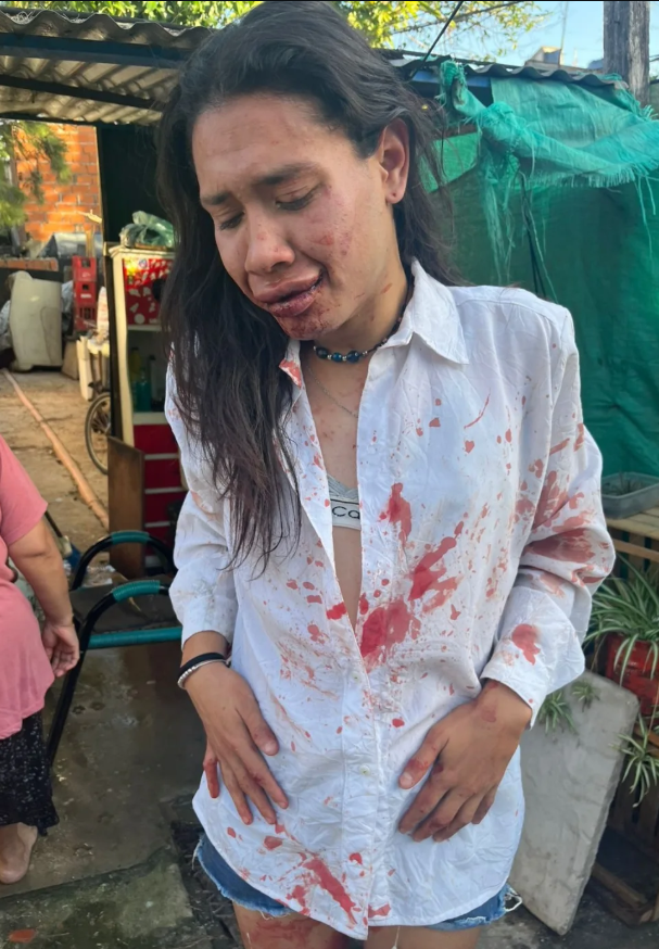 En la madrugada de Año Nuevo, la localidad de Don Torcuato fue escenario de un violento ataque contra Verdún Mar Desire. Según consta en la denuncia penal, la víctima fue interceptada en la vía pública por un grupo de personas, lo que confirma que se trató de un accionar colectivo. El Frente de Disidencias en Lucha en Argentina (FDELA), organización que visibilizó el caso, denunció la extrema crueldad de los agresores, quienes la golpearon y patearon en el suelo tras haberla acorralado.